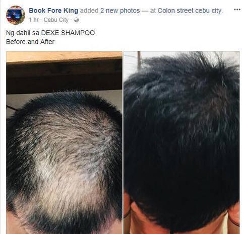 Dexe Anti Hair Loss Shampoo